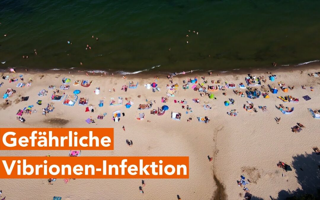 Extrem gefährliche Vibrionen-Infektion – erster Fall in diesem Jahr an der Ostsee